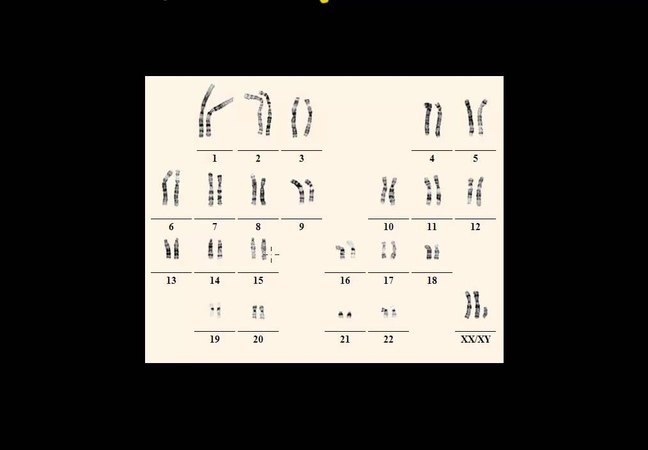 Karyotype