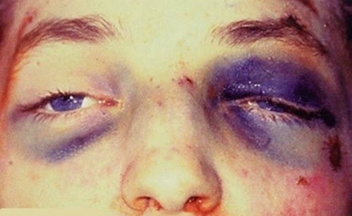 Барри Оаш | Москва