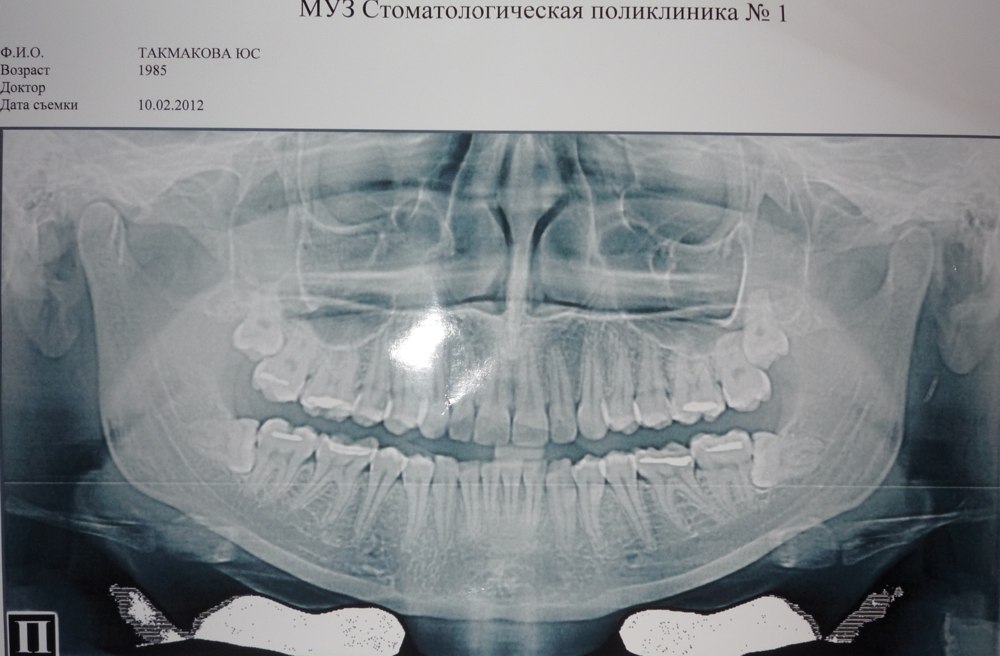 Фото профиля