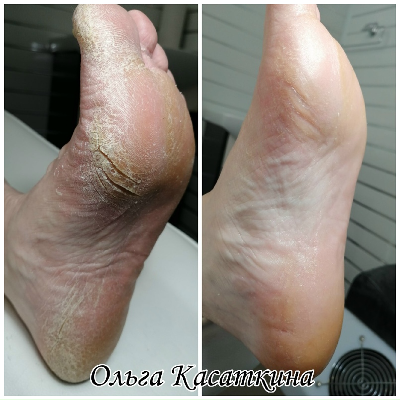 Ольга Касаткина | Березники