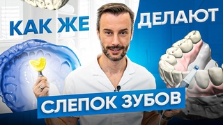 Оттиск с зубов альгинатной массой. Зачем делают и как снимают альгинатные слепки