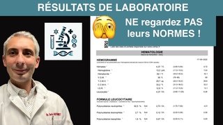 Pourquoi je n'utilise pas les normes des laboratoires