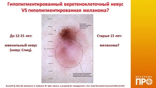 Гетьман А.Д. Дифференциальная дерматоскопическая диагностика редких...