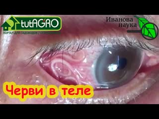 ВЫНУЛИ ОГРОМНОГО ЧЕРВЯ ИЗ ЖИТВОТА! Избавляемся от своих паразитов быстро и безболезненно.